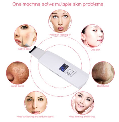 Ultrasonic Skin Scrubber for Blackhead Removal