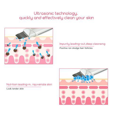 Ultrasonic Skin Scrubber for Blackhead Removal